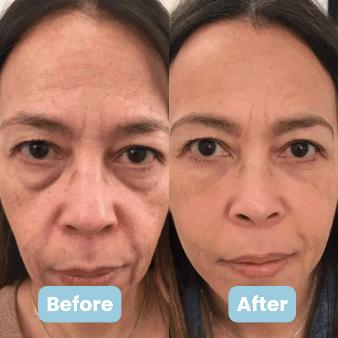 Dermawell 3-in-1 Face Sculptor™