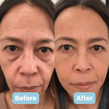 Dermawell 3-in-1 Face Sculptor™